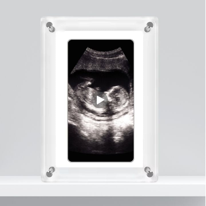 acryllic video frame with ultrasound video as a gift